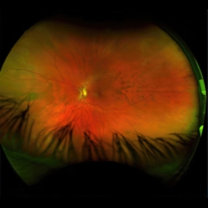 Puciato Greg - Mirrorcell (Black & Grey Splatter) ryhmässä VINYYLI @ Bengans Skivbutik AB (4186173)