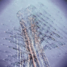 Radio Supernova - Takaisin